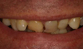 do-not-ignore-these-5-silent-symptoms-for-severe-health-3256355