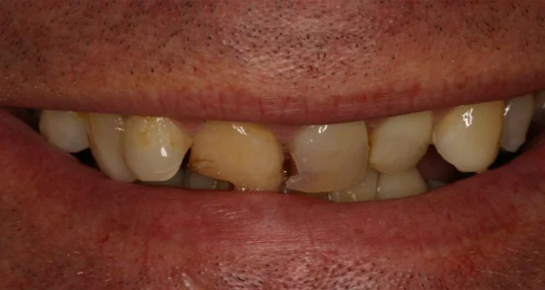 do-not-ignore-these-5-silent-symptoms-for-severe-health-3256355