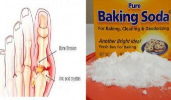 the-dangerous-effects-of-uric-acid-on-the-body-and-8-surprising-foods-that-help-to-keep-gout-in-check-4682125