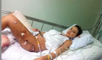 this-girl-felt-pain-in-her-buttocks-and-went-to-the-doctor-when-he-poked-hole-in-her-body-you-wone28099t-believe-what-came-out-7242581