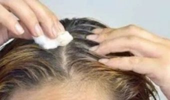 apply-this-on-scalp