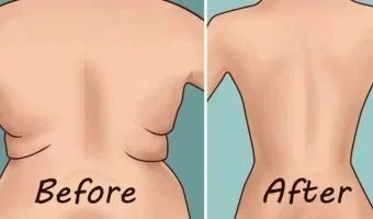 Eliminate Back Fat and Underarm Flab
